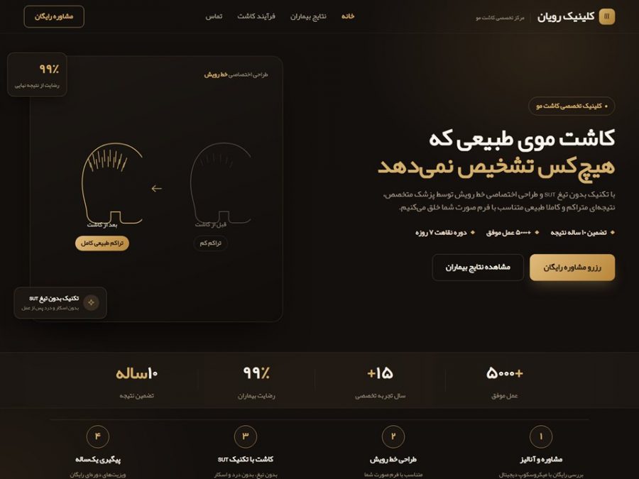 نمونه‌کار طراحی سایت کلینیک کاشت مو رویان
